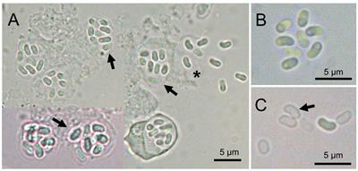 Nucleospora hippocampi n. sp., an Intranuclear Microsporidian Infecting the Seahorse Hippocampus erectus From China